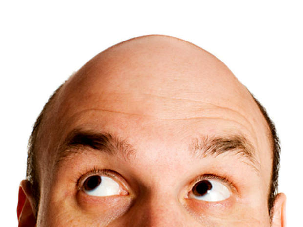 connecticut hair transplant clinic