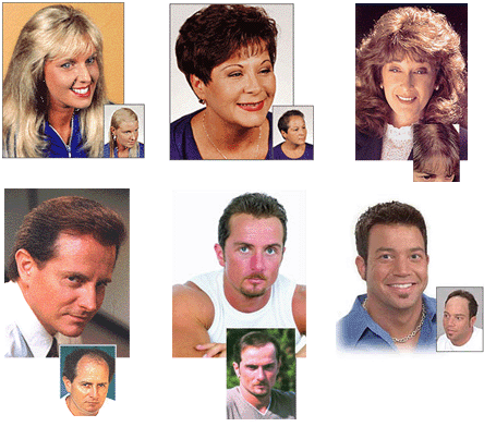 wyoming hair transplant clinic